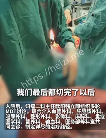 盆腹腔巨瘤