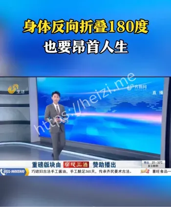 姜延琛折叠男孩手术成功