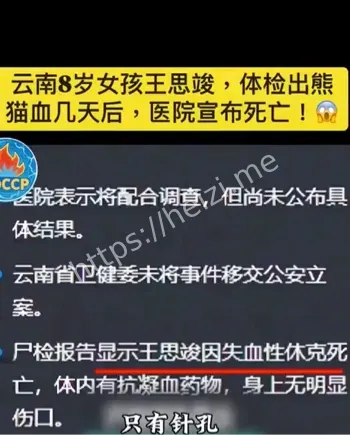 云南8岁女孩熊猫血