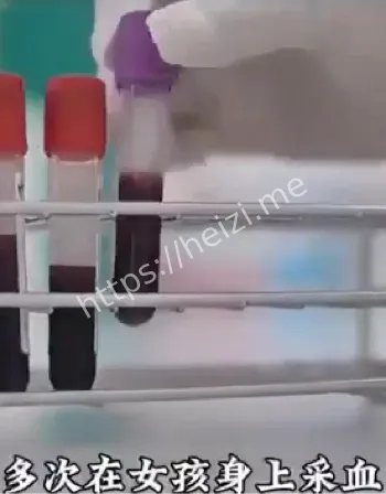 医院器官捐赠内幕曝光