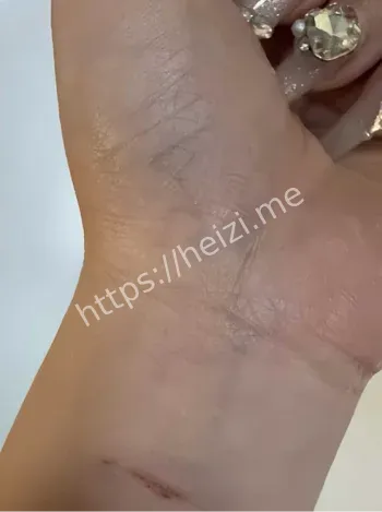 聊天记录和私密照曝光