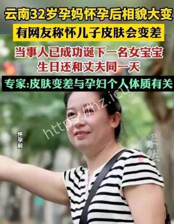 女子怀孕后相貌大变